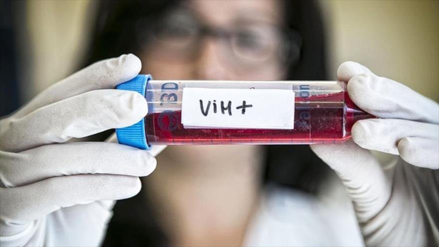 MORTALIDAD POR VIH CRECIÓ 48.7% DURANTE PANDEMIA